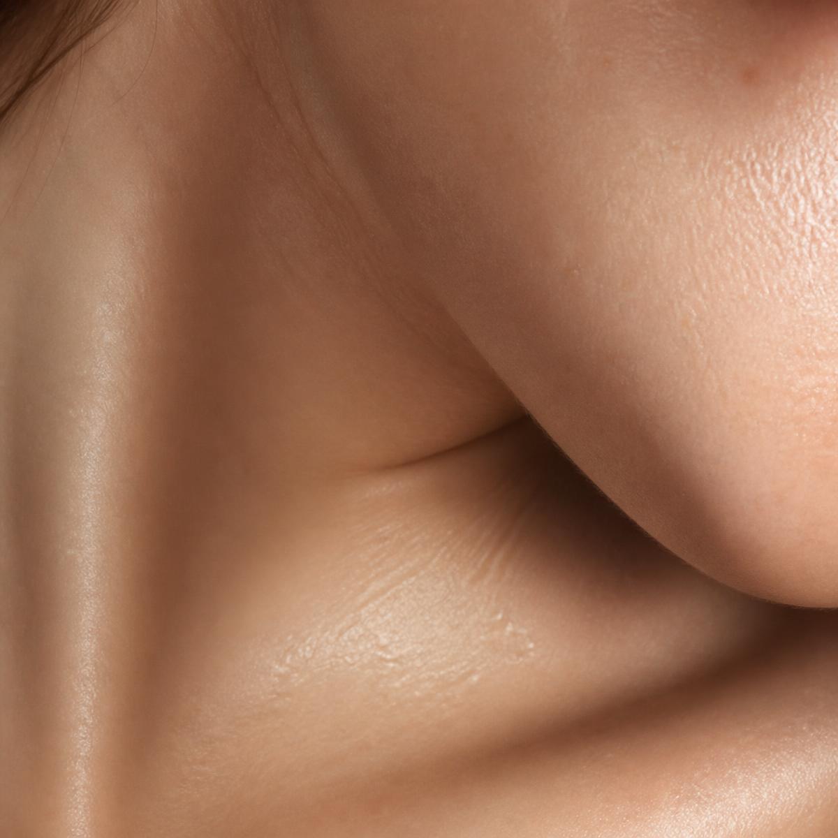 Microneedling — Behandlung bei BelleSkin Zürich